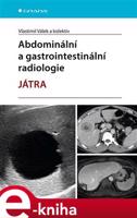 Abdominální a gastrointestinální radiologie - Játra - kolektiv, Vlastimil Válek