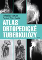Atlas ortopedické tuberkulózy - Dalimil Chocholáč, Miroslav Netval