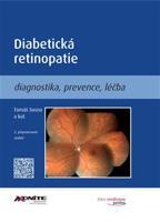 Diabetická retinopatie - Tomáš Sosna, kol.