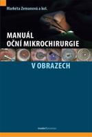 Manuál oční mikrochirurgie v obrazech - Markéta Zemanová, kol.