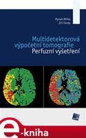 Multidetektorová výpočetní tomografie - Jiří Ferda, Hynek Mírka