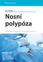 Nosní polypóza - Petr Schalek