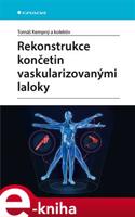 Rekonstrukce končetin vaskularizovanými laloky - Tomáš Kempný, kol.