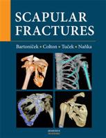 Scapular fractures - Jan Bartoníček, Christopher Colton, Michal Tuček, Ondřej Naňka