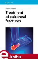 Treatment of calcaneal fractures - Vladimír Popelka