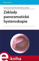 Základy panoramatické hysteroskopie - David Kužel, Dušan Tóth, Michal Mára