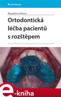 Ortodontická léčba pacientů s rozštěpem - Magdalena Koťová