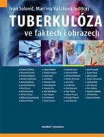 Tuberkulóza ve faktech i obrazech - kol., Ivan Solovič, Martina Vašáková