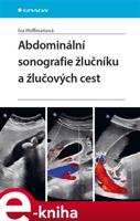 Abdominální sonografie žlučníku a žlučových cest - Iva Hoffmanová