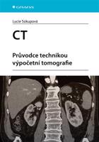 CT - Průvodce technikou výpočetní tomografie