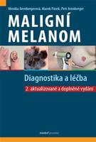 Maligní melanom – Diagnostika a léčba
