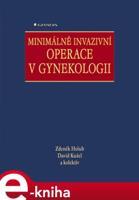 Minimálně invazivní operace v gynekologii - Zdeněk Holub, David Kužel