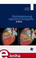 Multidetektorová výpočetní tomografie srdce - Jan Baxa, Jiří Ferda