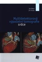 Multidetektorová výpočetní tomografie srdce - Jan Baxa, Jiří Ferda