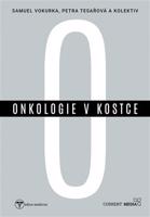 Onkologie v kostce