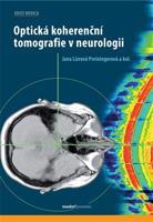 Optická koherenční tomografie v neurologii - Jana Preiningerová Lízrová, kol.