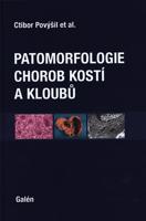 Patomorfologie chorob kostí a kloubů