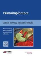 Primoimplantace totální náhrady kolenního kloubu - Karel Koudela st., Karel Koudela jr., Jana Koudelová, kolektiv