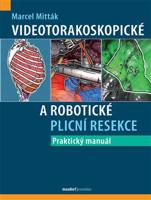 Videotorakoskopické a robotické plicní resekce - Marcel Mitták