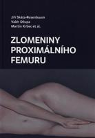 Zlomeniny proximálního femuru - Jiří Skála Rosenbaum, Valér Džupa, Martin Krbec, kol.